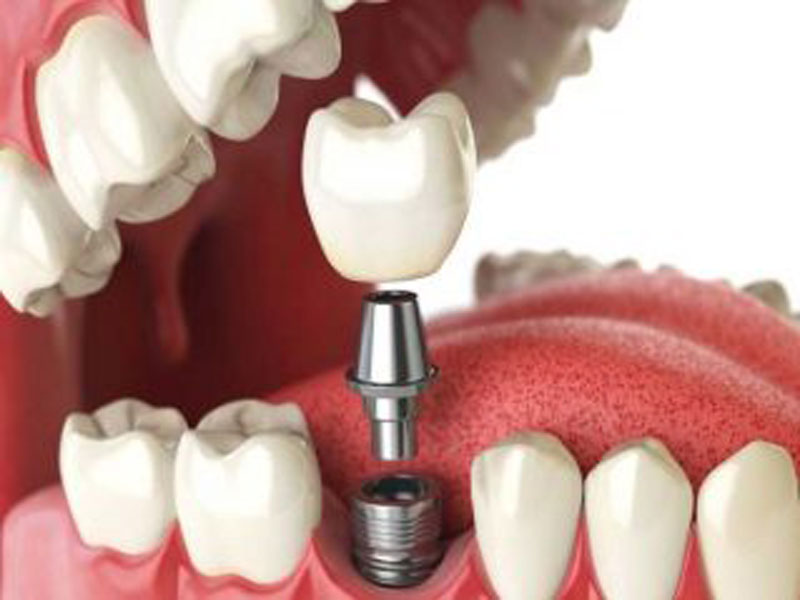 کلینیک دندانپزشکی ایده آل