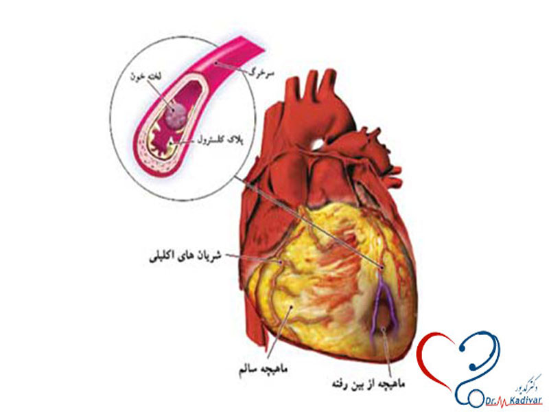 دکتر محمد هادی کدیور متخصص قلب و عروق