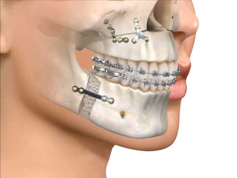 دکتر فرزاد فضیلت جراح دهان، فک و صورت