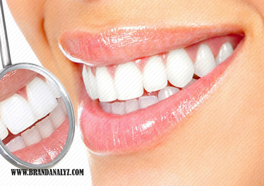 سفید کردن دندان توسط دندانپزشک ماهر