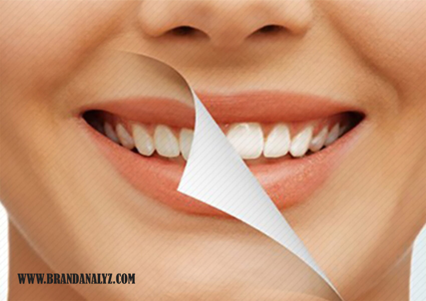 چند نکته مؤثر برای سفید کردن دندان با بلیچینگ